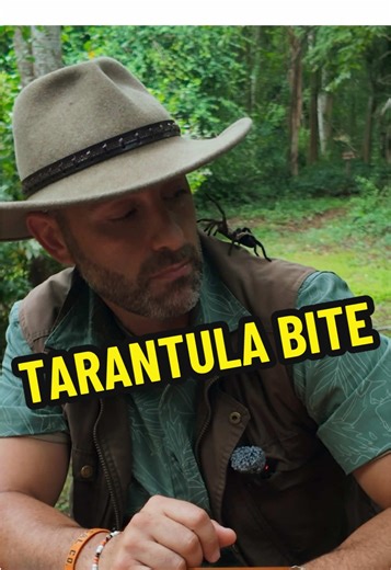 I’m Coyote Peterson and I’m about to enter the nibble zone with… this “gentle” tarantula! Not all bites are brutal. This one was a tiny chomp and felt no worse than a bee sting… at the time. But for the next 3 weeks, my arm was in tremendous discomfort. I had muscle spasms. It even seized up so badly it was like partial paralysis. The bite was nothing, but the venom was another story… Don’t miss this new episode on the @bravewilderness YouTube channel! #coyotepeterson #bravewilderness #bugs #sca