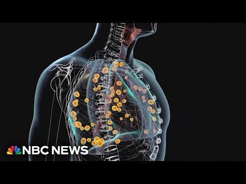 Mysterious illness sickens dozens in Tennessee