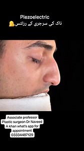 #NoseCorrection #DeviatedNoseSurgery #NoseReshaping #NoseSurgery #NoseTransformation #BeautifulNose #PlasticSurgery #TransformationStory #SurgerySuccess #BeforeAfter #HappinessThroughNose #BeautySecrets #FacialBeauty #ProperNose #BenefitsOfSurgery #SurgicalProcedure #HealthandBeauty #ConfidenceBoost #CosmeticEnhancement #NoseJob | Dr Naveed A Khan Plastic Surgeon