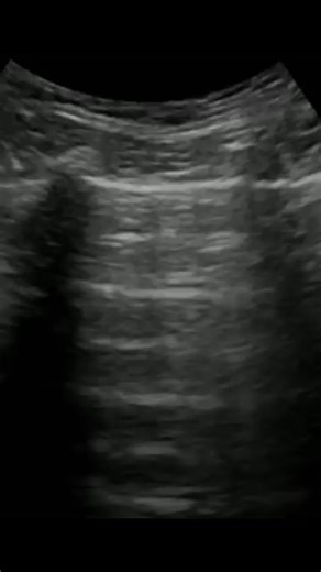 Understanding Ultrasound Technology for Appointments