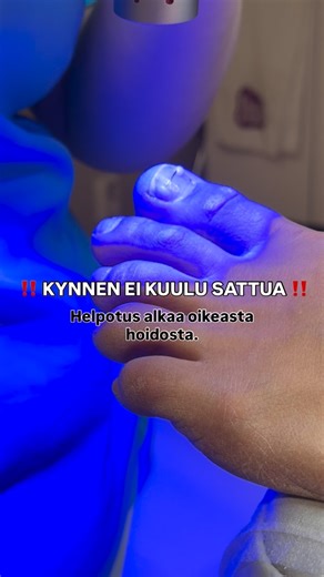 Jalkaklinikka Kristalli | Jalkojenhoito & Jalkaterapia on Instagram: "Kärsitkö varpaankynsien kivusta? Kynnenoikaisu on hellävarainen ja tehokas apu sisäänkasvaviin, kaartuneisiin tai kivuliaisiin kynsiin. ✨ Meillä on käytössä kaksi toimivaa menetelmää: 🔹 Titaanikynnenoikaisu – vahva ja huomaamaton ratkaisu, joka ohjaa kynnen kasvua oikeaan suuntaan 🔹 Podofix – kevyt ja yksilöllinen oikaisu, sopii myös herkemmille kynsille ✔️ Kivuton hoito ✔️ Ei leikkausta ✔️ Helpottaa kipua nopeasti ✔️ Sopii