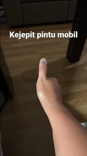 Finger Slammed in Car Door