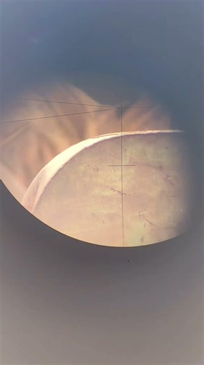 “Auto level (Upper stadia, Middle stadia and Lower stadia) view.”