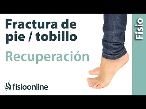 Recovery from foot and ankle fractures - Walking on toes, heels, outside, inside