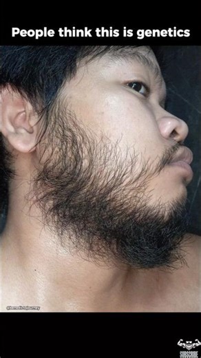 People Thought It Was Genetics… They Were Wrong