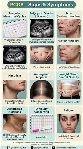 PCOS Explained | Signs & Symptoms of Polycystic Ovary Syndrome | Gynecology #medicalstudents