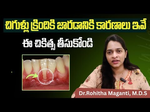 చిగుళ్లు కిందకి జారుతున్నాయా? | Gum Recession- Causes, Treatment | Dr Explains 