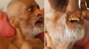 South African hospital patient has maggots wriggling in his mouth