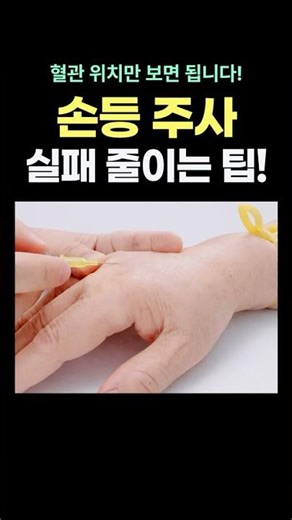 Top 4 Injection Vein Locations on the Back of the Hand #Nurse #BackoftheWrist #IntravenousInjecti...