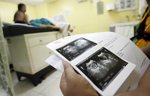 ‘HIV testing was compulsory. If you didn’t test, they wouldn’t treat you’