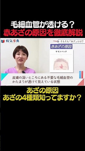 【かんたん解説】毛細血管が透けるのが赤あざ？#ほくろ #医療 #苺状血管腫 #あかちゃんの病気#shorts