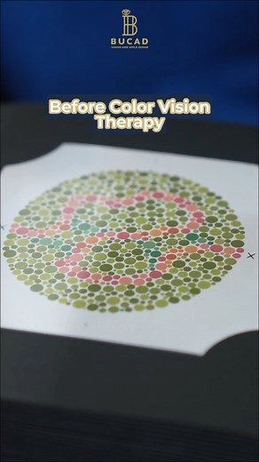 Having trouble with your color vision? Don’t guess. Don’t self-diagnose. We can check it properly and guide you with the right solution based on real testing and real data. FOR APPOINTMENTS & INQUIRIES 📍 Unit 1621, 16th Floor, Centuria Medical Makati 📞 0917-876-8963 | 0917-108-1528 💬 facebook.com/drbucadvisionandsmilerehab 🖥 Online Consultation Available 📲 Download our app for a FREE dental scan AI-powered assessment: apps.apple.com/ph/app/scano-ai-dental-checkups/id1556646708 | Bucad Visio
