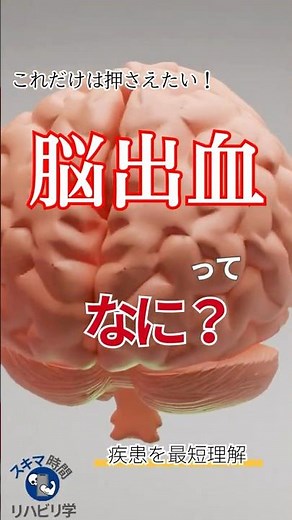 【基礎】脳出血ってなに？ #理学療法士国家試験 #理学療法士 #作業療法士国家試験 #作業療法士 #基礎 #脳 #脳出血 #脳卒中 #皮質下出血 #被殻出血 #視床出血 #脳幹出血 #小脳出血