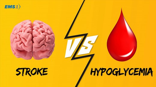 Stroke vs. hypoglycemia: Know the difference