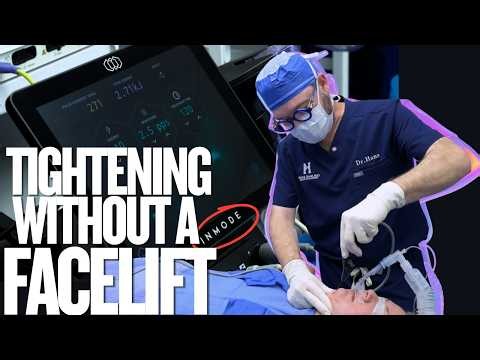 Can Quantum RF Tighten Loose Skin? | Chin, Neck & Jawline Treatment
