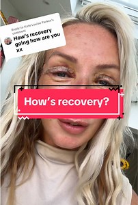 Understanding Recovery After Face and Neck Lift Surgery