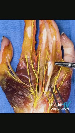 Dr. Tom Walters, DPT, OCS on Instagram: "💥𝐇𝐚𝐧𝐝 𝐀𝐧𝐚𝐭𝐨𝐦𝐲💥 —— 👉Here’s an awesome dissection of the palm of the hand from @seattlesciencefoundation. 🔎The flexor digitorum superficialis and profundus tendons as well as the lumbrical muscles can be observed. #RehabScience"