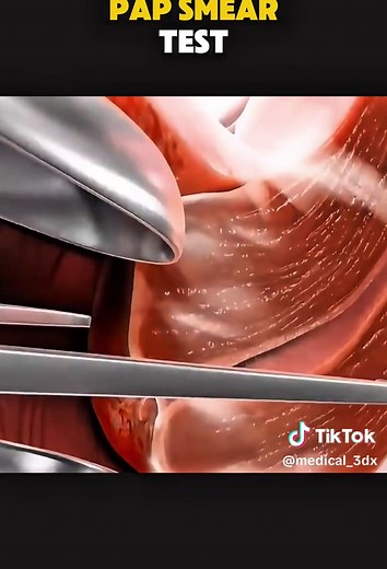Pap Smear Test: 3D Animation for Women's Health