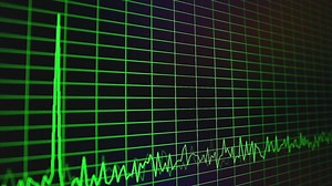 Digital oscillogram on the screen - Free Stock Video