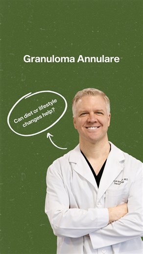 Dr. Boswell | Board-Certified Dermatologist on Instagram: "🤔 Granuloma Annulare: Can diet or lifestyle changes help? We wish it were that simple, but the truth is, there’s no real evidence that cutting out gluten or going plant-based will make GA go away. Granuloma annulare is an autoimmune reaction targeting collagen in the dermis, that’s why most topical treatments don’t work. Creams and ointments can’t reach deep enough to stop the inflammation. Instead, I’ll walk you through what does work,