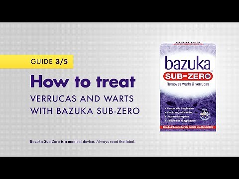 How to treat verrucas and warts with Bazuka Sub-Zero