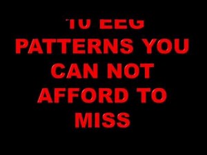 10 EEG Patterns You Can Not Afford to Miss