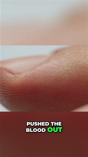 Do you have poor circulation? Find out now #healthtips #bloodflow #shorts