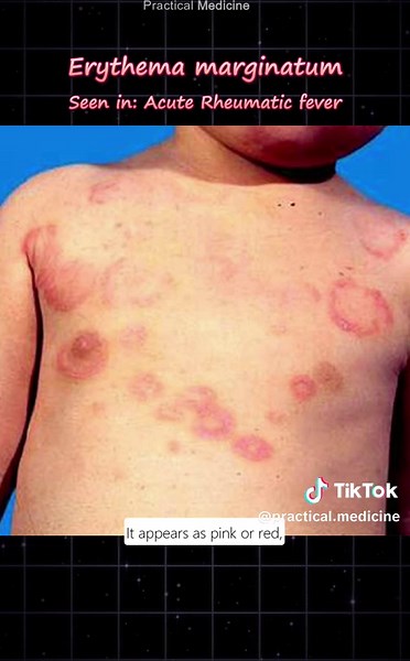 Identifying Rashes: Conditions and Associations