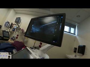 Actual Tenex Procedure for Tendinosis in Achilles Tendon