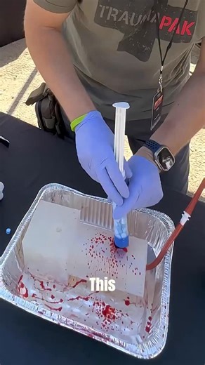 Science hub on Instagram: "The video shows a special syringe that can instantly stop heavy bleeding. It works by injecting tiny compressed cellulose sponge particles directly into the wound. Once inside, the sponges rapidly expand up to 20 times their size, filling the wound cavity and creating strong internal pressure — a tamponade effect — that stops bleeding within seconds. Each sponge contains a radiopaque marker, so doctors can see them clearly on X-rays. The material is biocompatible and d