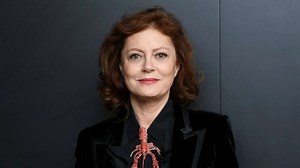 Susan Sarandon shares photos from a 'little slip' that gave her a concussion and other injuries