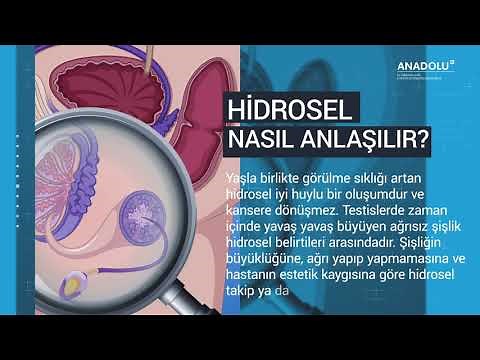 Hidrosel ameliyatı ve iyileşme süreci