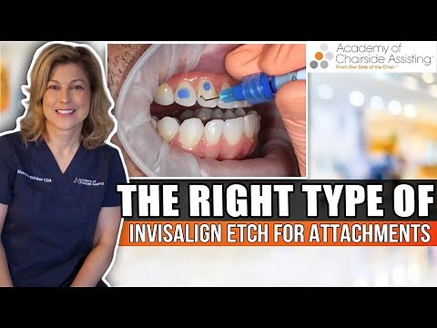 Using the right etch for Invisalign Attachment Placement