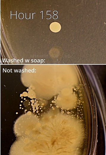 Bacteria Growth in Petri Dishes: Timelapse Footage