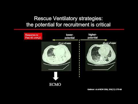 Measuring (and interpreting) Transpulmonary Pressures by Dr Salvatore Grasso MD.