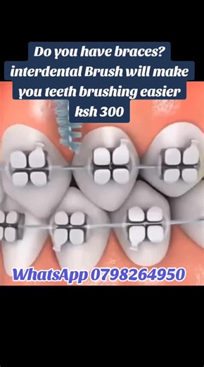 #mirahndentalcare #braceskenya #interdentalbrush #bracestips