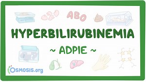 Hyperbilirubinemia: Nursing process (ADPIE): Video, Causes, & Meaning | Osmosis