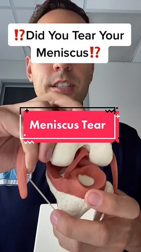 Meniscus Tear: Understanding the Injury, Surgery, and Recovery Process