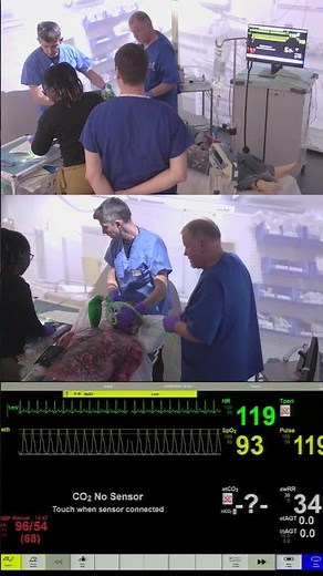 Anaesthetics Simulation – Burns Airway Emergency with Front of Neck Access (FONA)