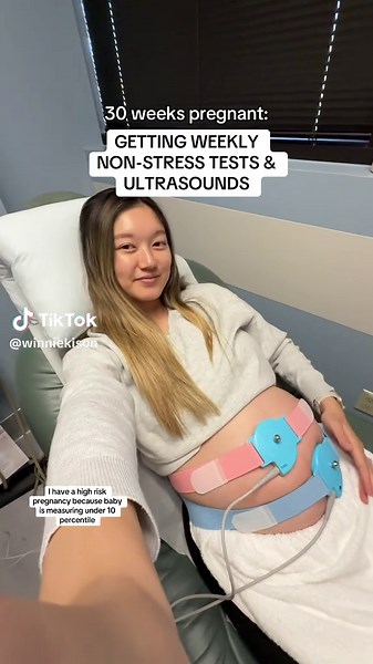 Weekly Non-Stress Tests for a Safe Pregnancy Journey