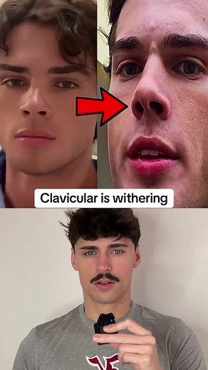 Clavicular seems to be withering in recent clips #clavicular #withering #foryou