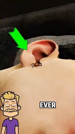 What to do if a cockroach crawls into your ear 😱