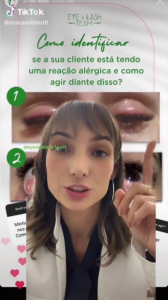 Como Diferenciar Alergia de Ceratite em Olhos Vermelhos