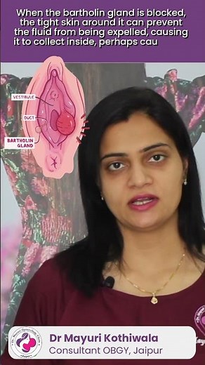What Causes Bartholin Cyst in Hindi - बार्थोलिन सिस्ट का क्या कारण है? - By Dr. Mayuri Kothiwala