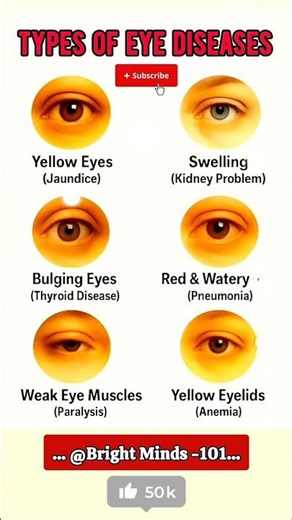 What Your Eyes Reveal About Your Health | Signs Of Disease In Eyes Explained #healthylifestyle