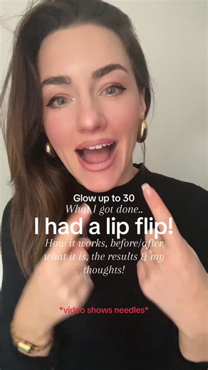 My Glow Up to 30 Lip Flip: Before & After Results Revealed!
