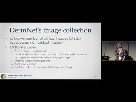 Skin Disease Image Recognition – DermNet's Update