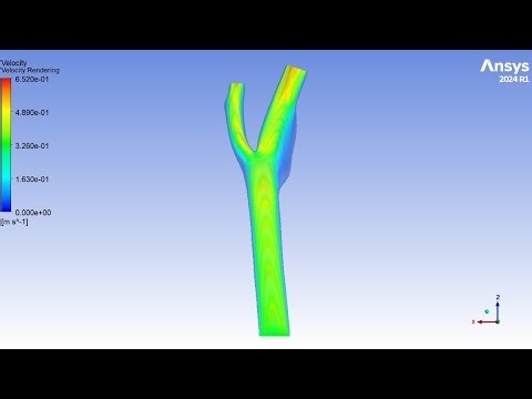 Carotid Bifurcation Artery (steady) | ANSYS Fluent