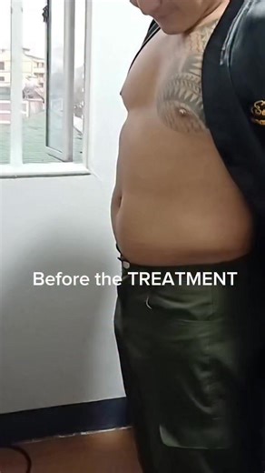 Lumaki ba ang iyong Belly this Holiday???? Heto na ang sagot sa iyong problema 👌 MESSO BELLY AND EXILIFT TREATMENT Euwin Aesthetic and Wellness Center 📍Room 507, Mount Crest Hotel, #1 Legarada Road Baguio City Book your Appointment now! call: 639184834015 email: euwinaesthetic@gmail.com visit Their Facebook Page. | The Torogi Wonderer