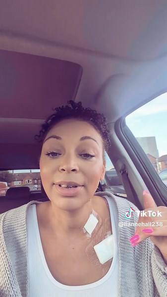 Navigating Cancer Treatment: My Portacath Experience